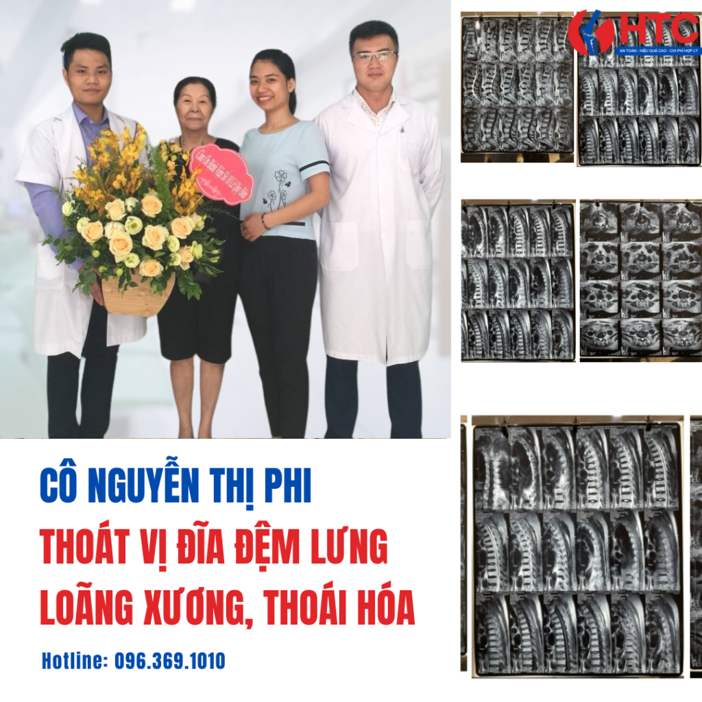 KHỎI THOÁT VỊ ĐĨA ĐỆM, THOÁI HÓA, ĐAU NHỨC XƯƠNG KHỚP