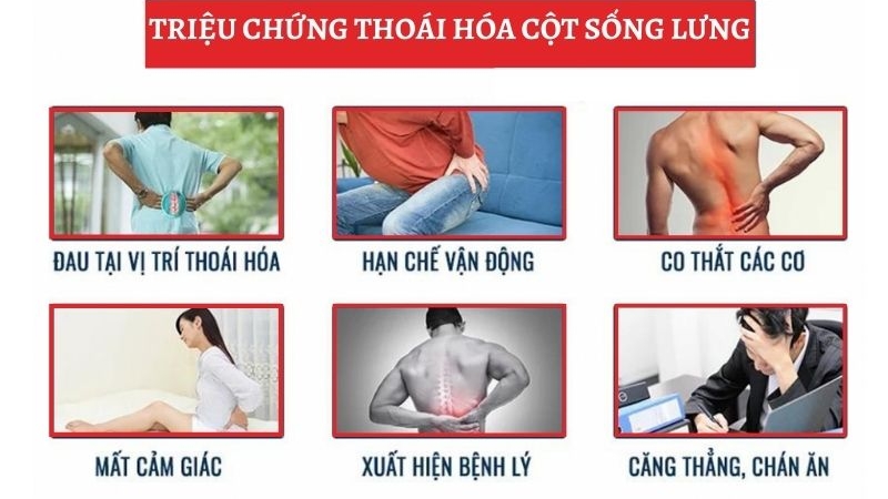 Dấu hiệu thoái hóa cột sống thắt lưng