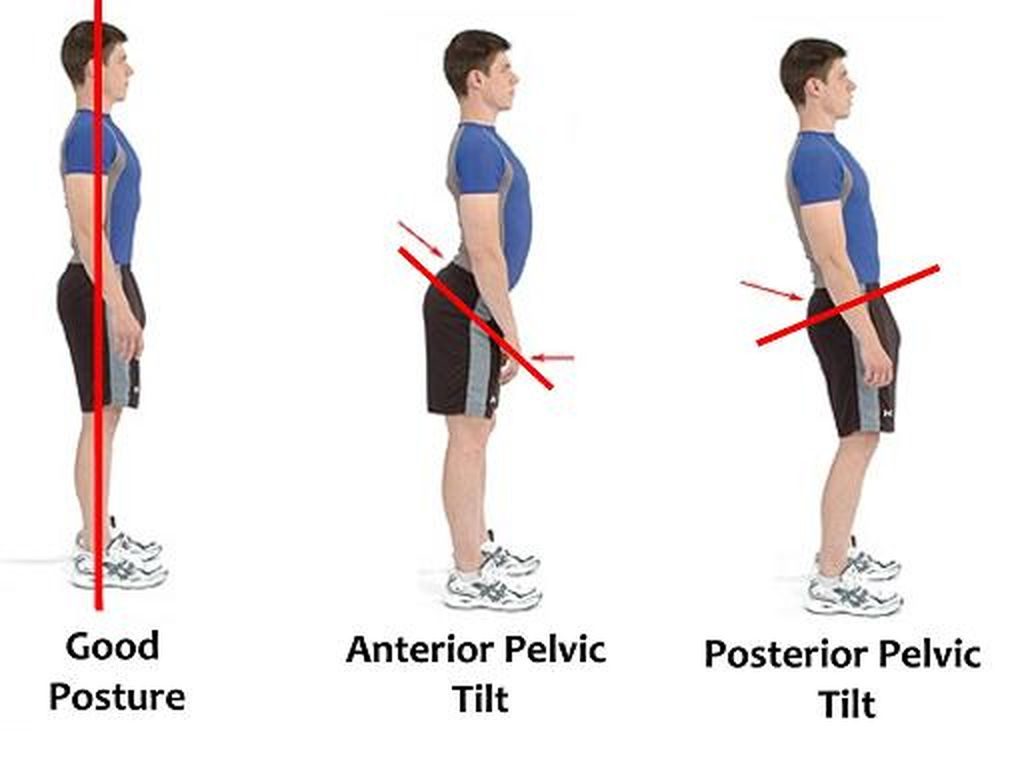 mất đường cong cột sống thắt lưng