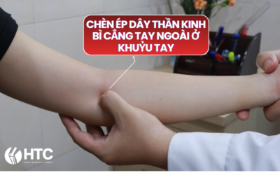 chữa chèn ép thần kinh bì khuỷu tay