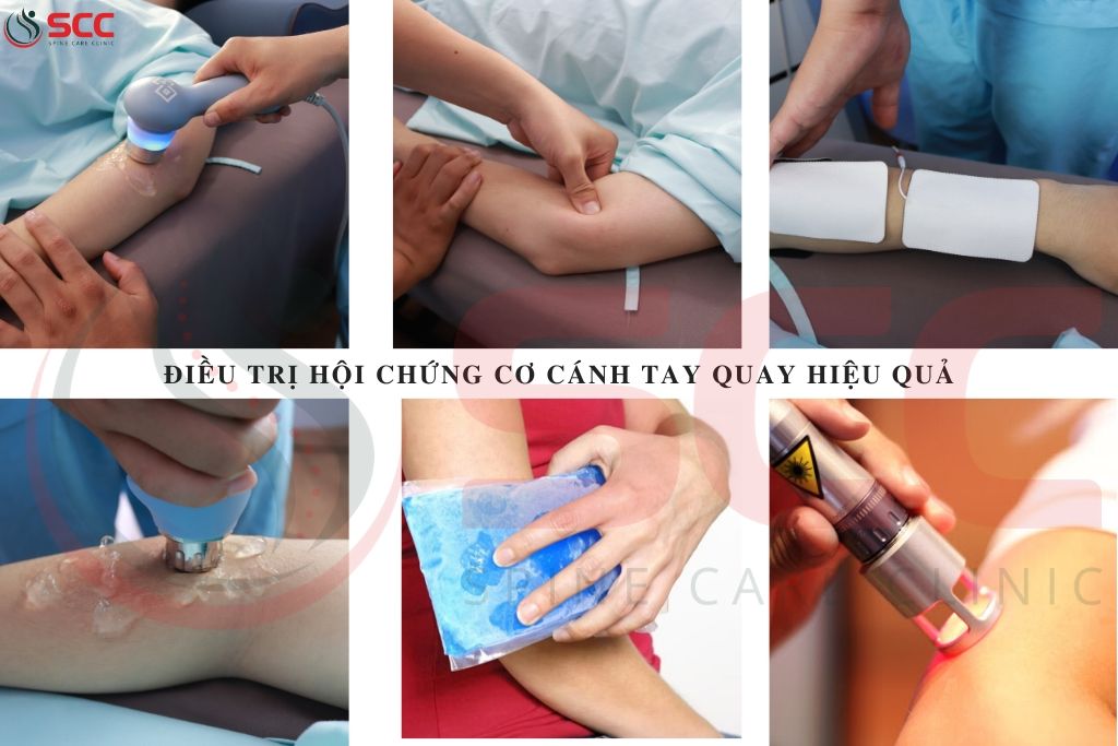 điều trị hội chứng cơ cánh tay quay hiệu quả
