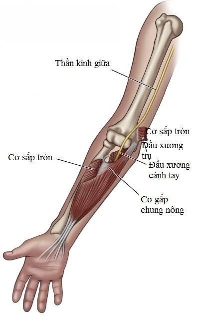 Dấu hiệu và triệu chứng của hội chứng cơ sấp cẳng tay