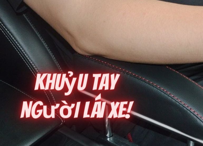 khuỷu tay người lái xe