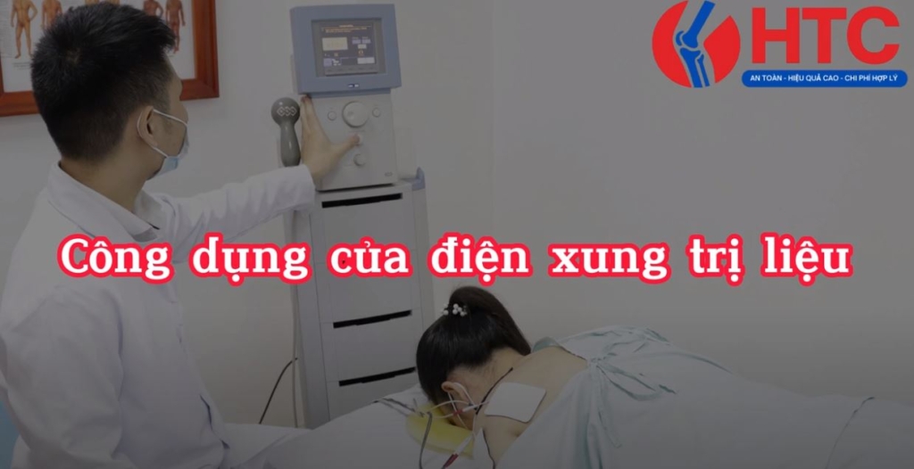 công dụng của điện xung trị liệu