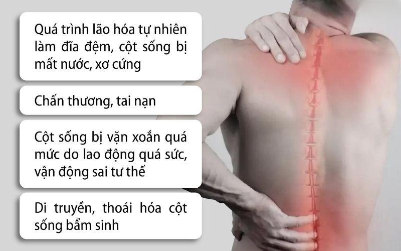 Nguyên nhân gây thoát vị 