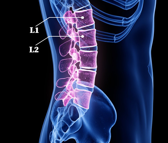 loại thoát vị lưng