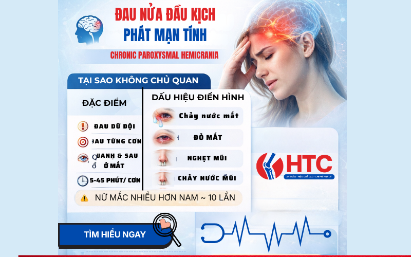 đau nửa đầu lịch phát mạn tính