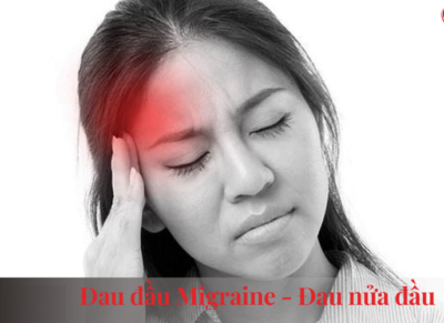 đau đầu migraine, đau nửa đầu