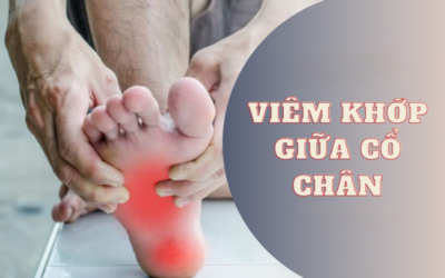 Viêm khớp giữa cổ chân