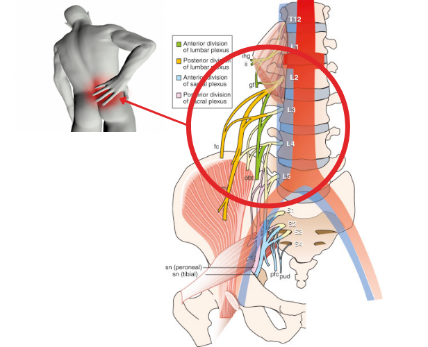 bệnh lý rễ thần kinh cột sống thắt lưng