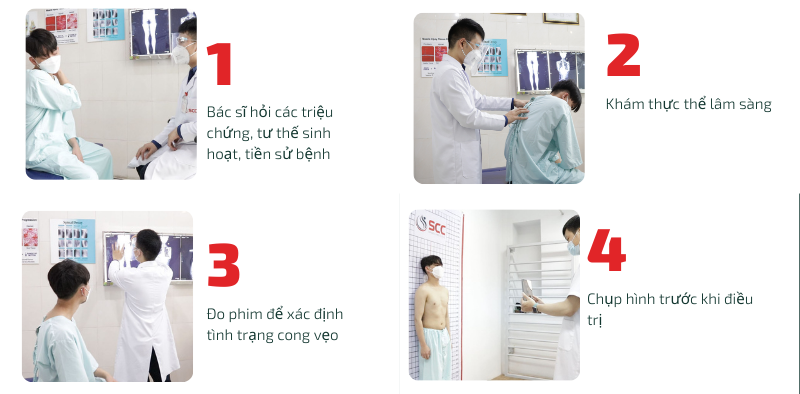 khám cong vẹo cột sống tại SCC