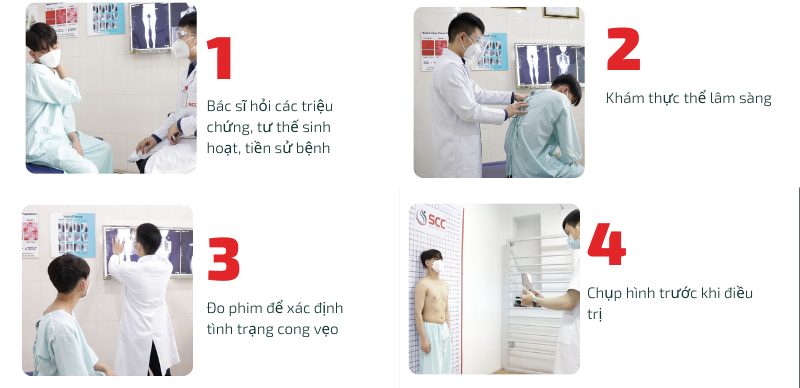 khám vẹo cột sống tại scc