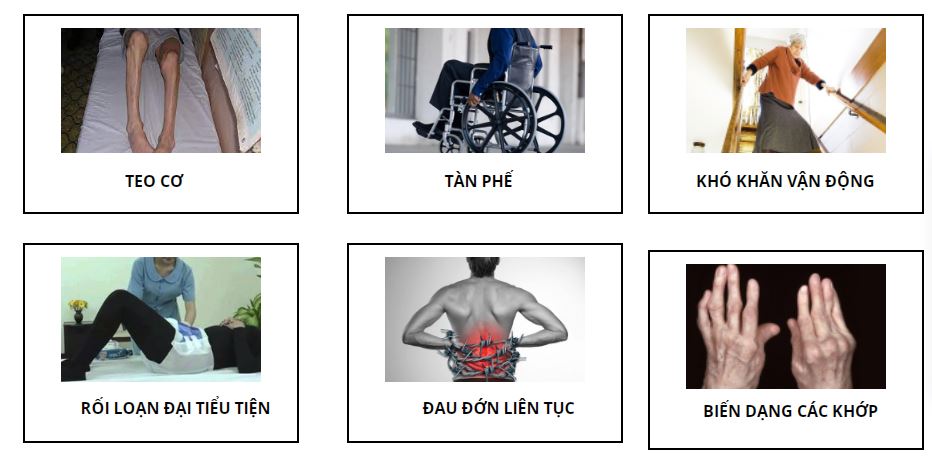 hậu quả của bệnh cột sống