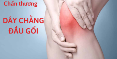 các chấn thương dây chằng đầu gối