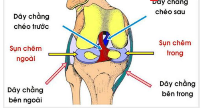 đứt bán phần dây chằng chéo