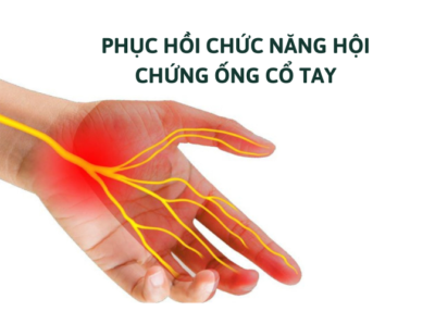 Đau dây thần kinh hông to-Triệu chứng, cách điều trị tốt nhất