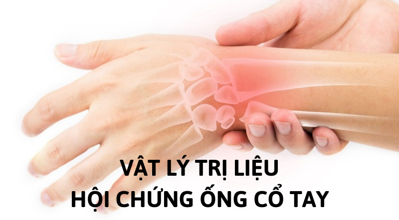 hội chứng cổ tay