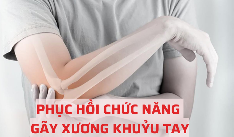 gãy xương khuỷu tay