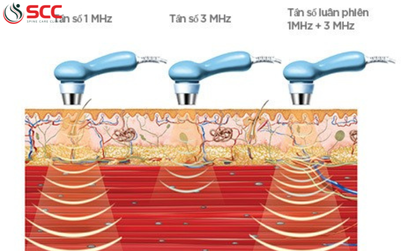 tác dụng của siêu âm