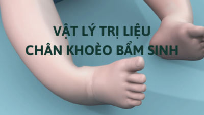 vật lý trị liệu chân khoèo