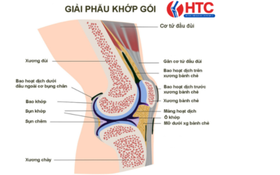 viêm cơ khớp gối