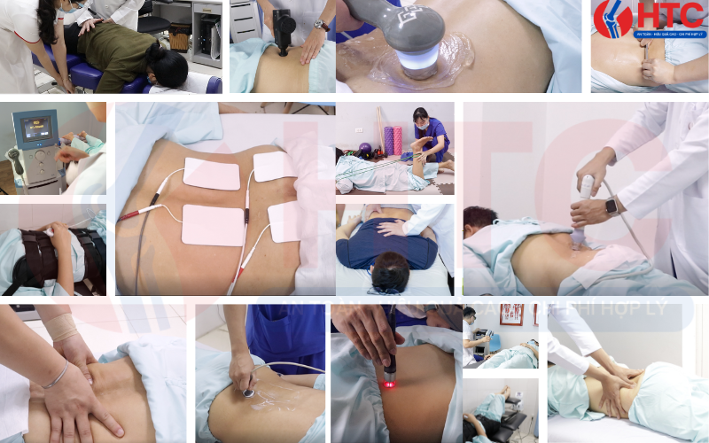 điều trị thoát vị đĩa đệm lưng