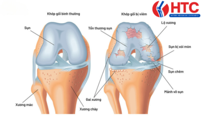 Phòng Khám Cơ Xương Khớp HTC