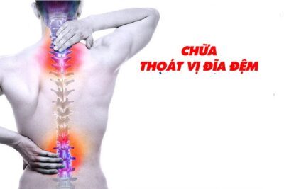 chữa thoát vị đĩa đệm