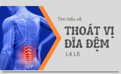 Thoát vị đĩa đệm L4 L5