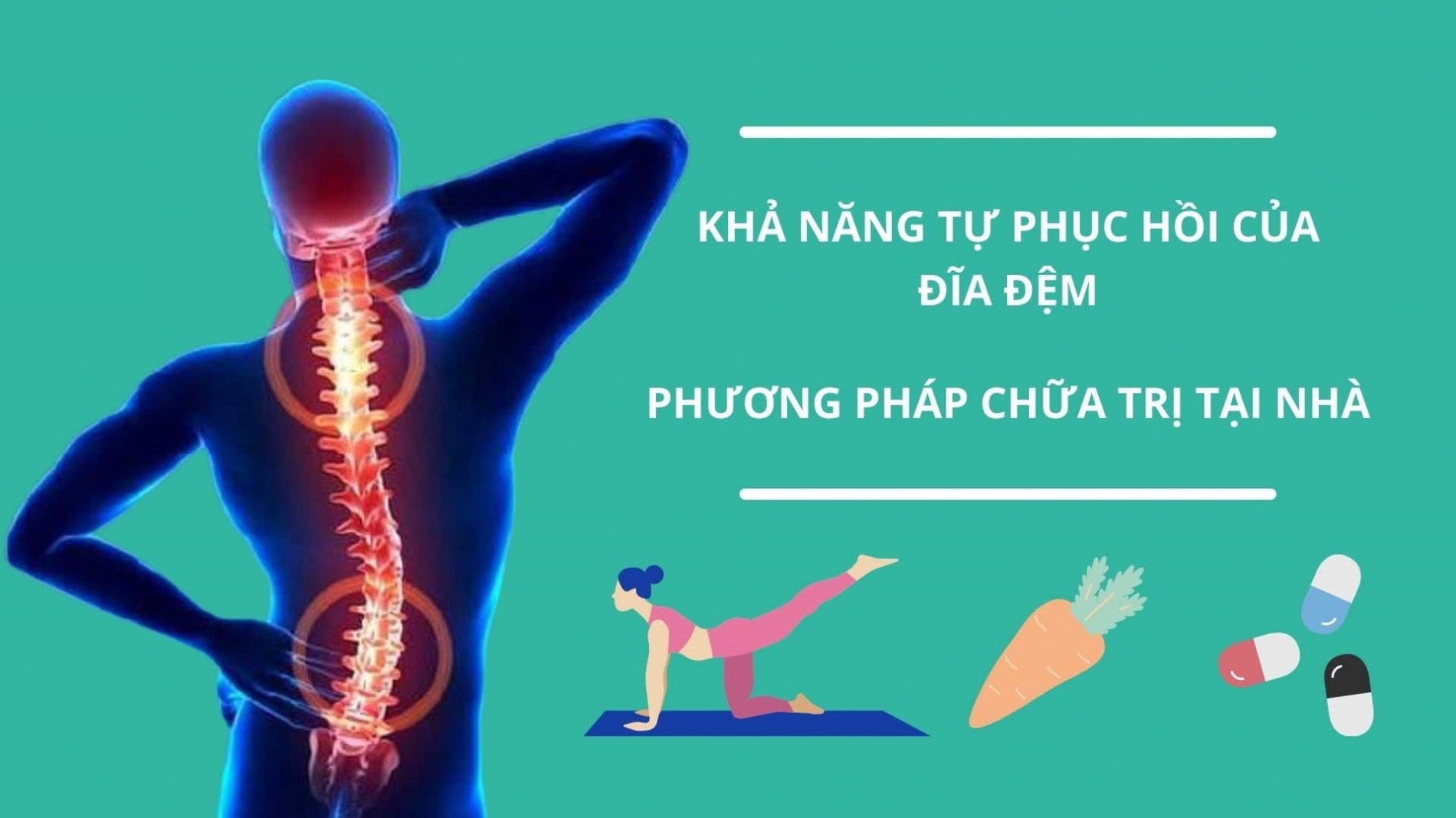 Các phương pháp hỗ trợ điều trị thoát vị đĩa đệm