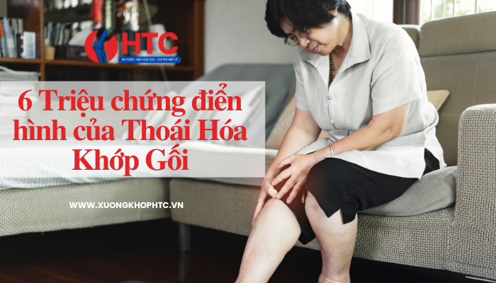 6 biểu hiện điển hình của thoái hóa khớp gối