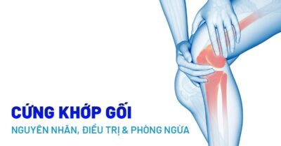 Đau cứng khớp gối