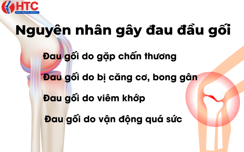 đau gối khi chơi thể thao