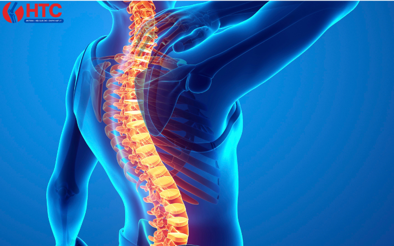 Người có tiền sử bệnh lý cổ 