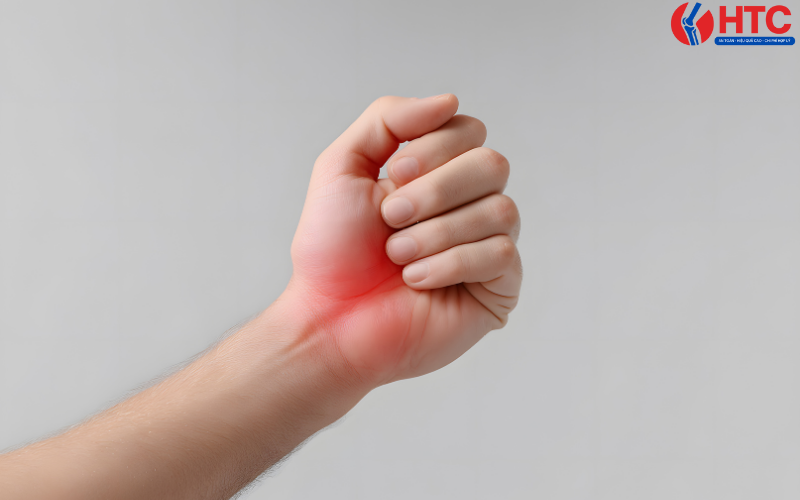 đau cổ tay, tê tay