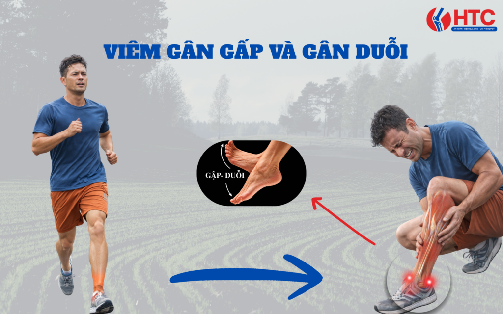 Viêm gân gấp và gân duỗi