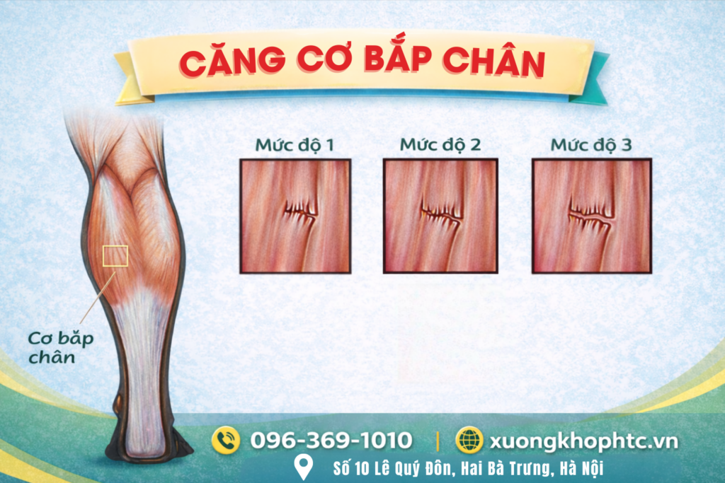 Căng cơ bắp chân