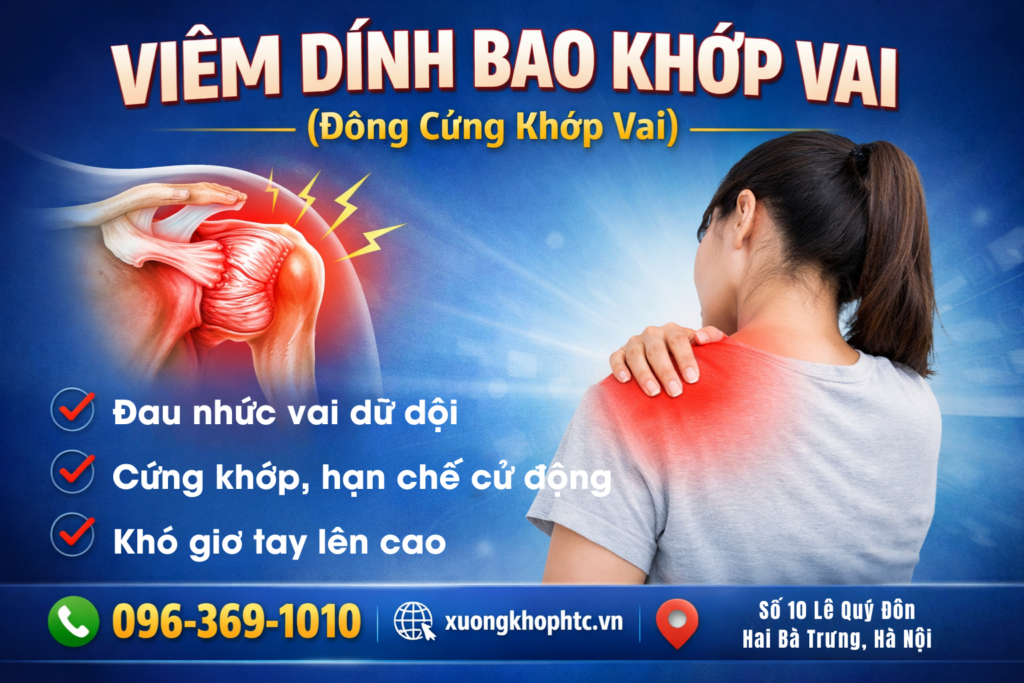 viêm dính bao khớp vai