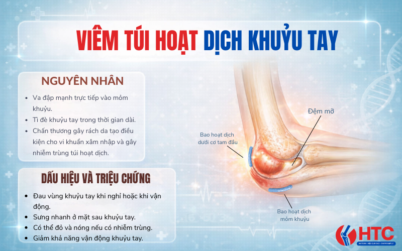 Viêm túi hoạt dịch khuỷu tay