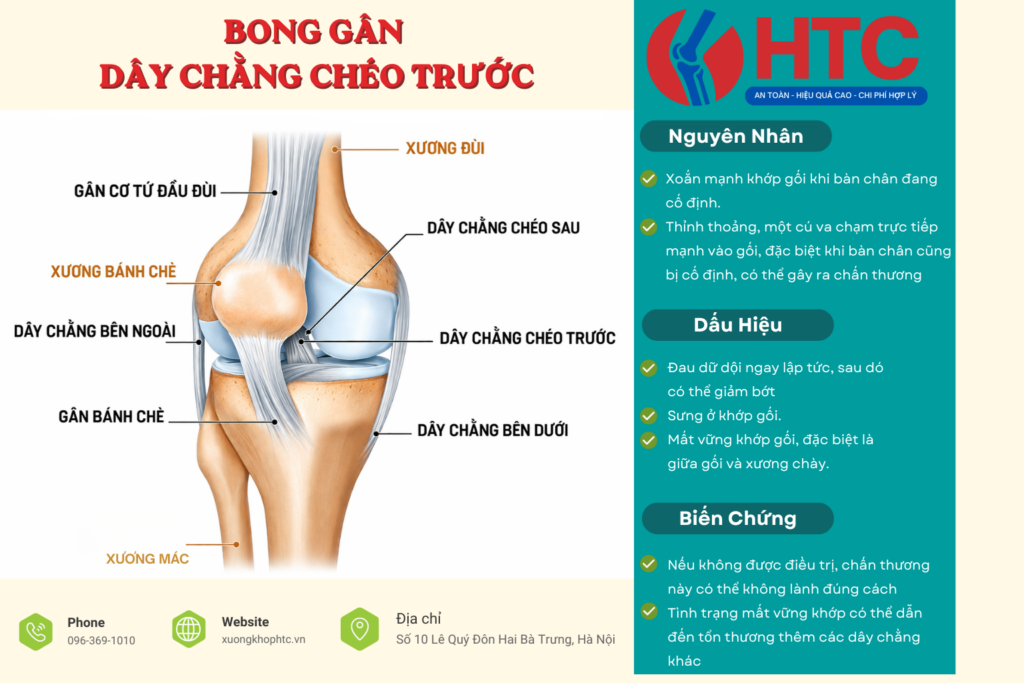 Bong Gân Dây Chằng Chéo Trước