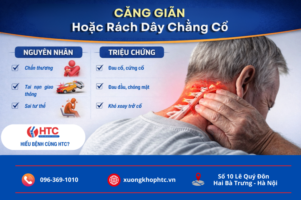 Căng giãn hoặc rách dây chằng cổ