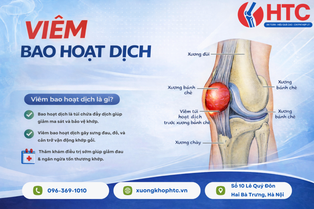 Viêm Bao Hoạt Dịch