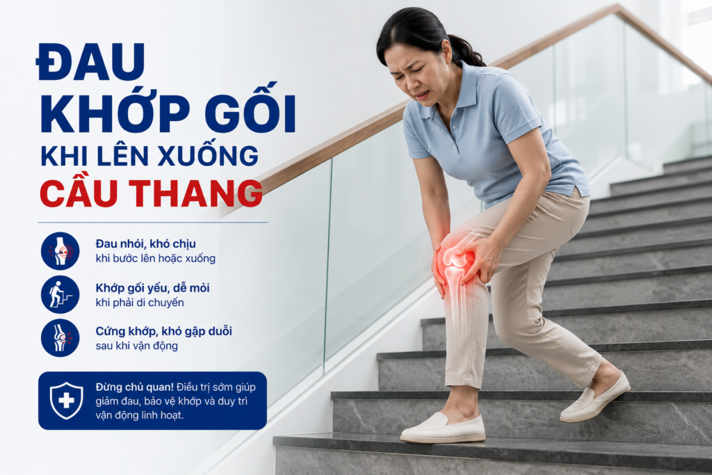 ĐAU KHỚP GỐI KHI LÊN XUỐNG CẦU THANG – ĐỪNG CHỦ QUAN!