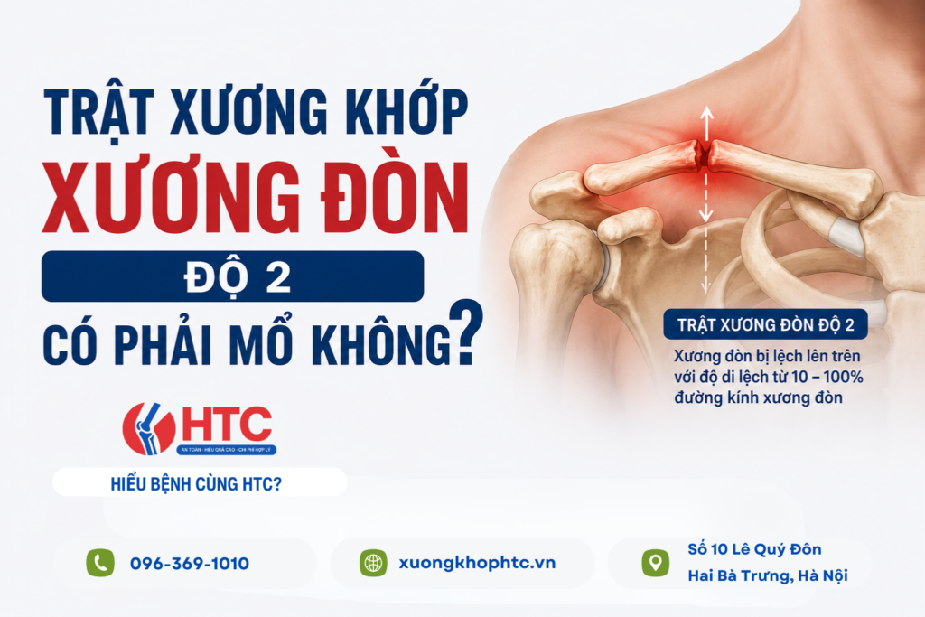 Trật xương khớp xương đòn độ 2 có phải mổ không?