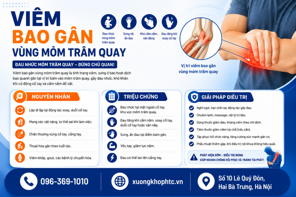 Viêm bao gân vùng mỏm trâm quay