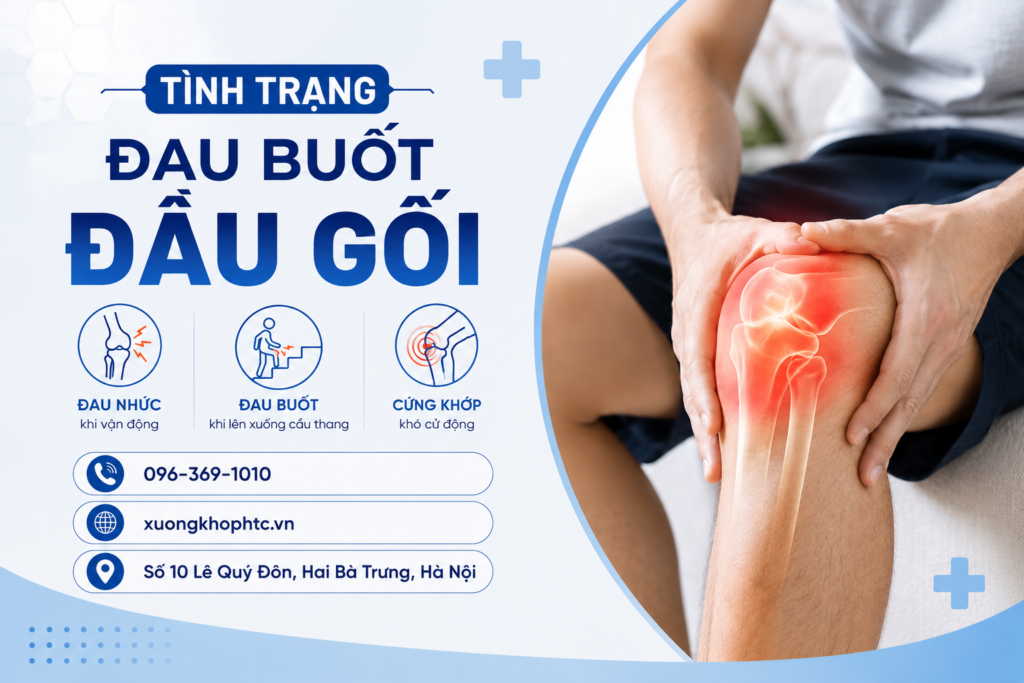 Tình Trạng Đau Buốt Đầu Gối – Nguyên Nhân Và Cách Cải Thiện