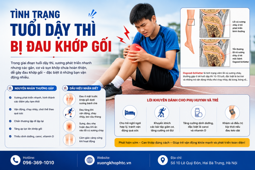 Tình Trạng Tuổi Dậy Thì Bị Đau Khớp Gối: Nguyên Nhân, Dấu Hiệu Và Cách Khắc Phục