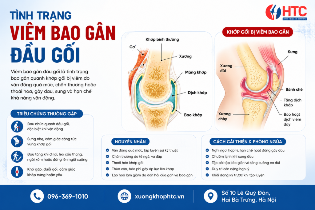 Tình Trạng Viêm Bao Gân Đầu Gối: Nguyên Nhân, Triệu Chứng Và Cách Cải Thiện