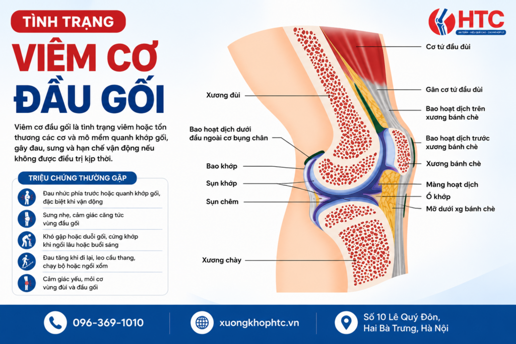 Tình Trạng Viêm Cơ Đầu Gối: Nguyên Nhân, Triệu Chứng Và Cách Khắc Phục