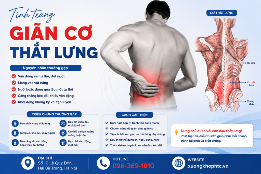 Tình Trạng Giãn Cơ Thắt Lưng: Nguyên Nhân, Triệu Chứng Và Cách Phục Hồi